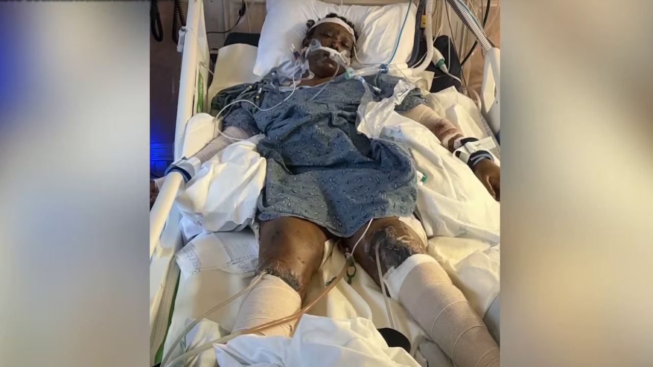 Woman Arrested After Mother of Three Suffers Critical Injuries in Brutal Dog Attack