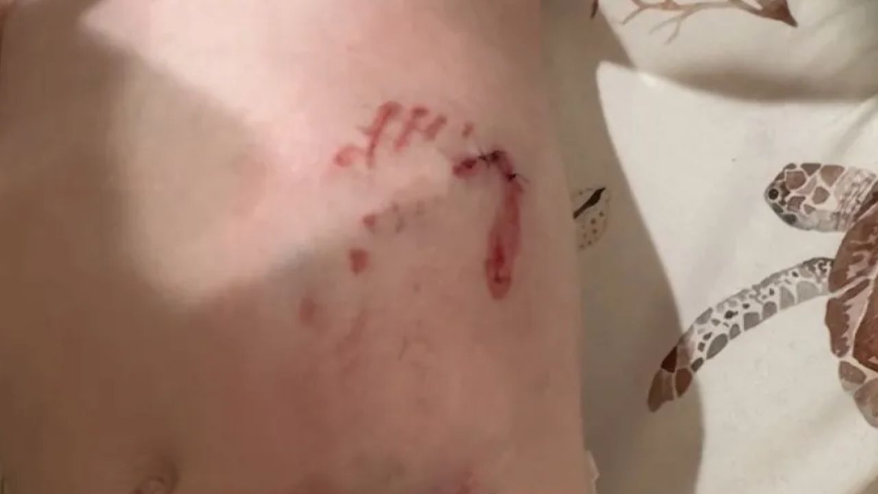 A raccoon lunged at a 2-year-old on a playground — and his parents never saw it coming